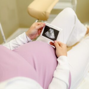 Ginekologija ultrazvuk slika