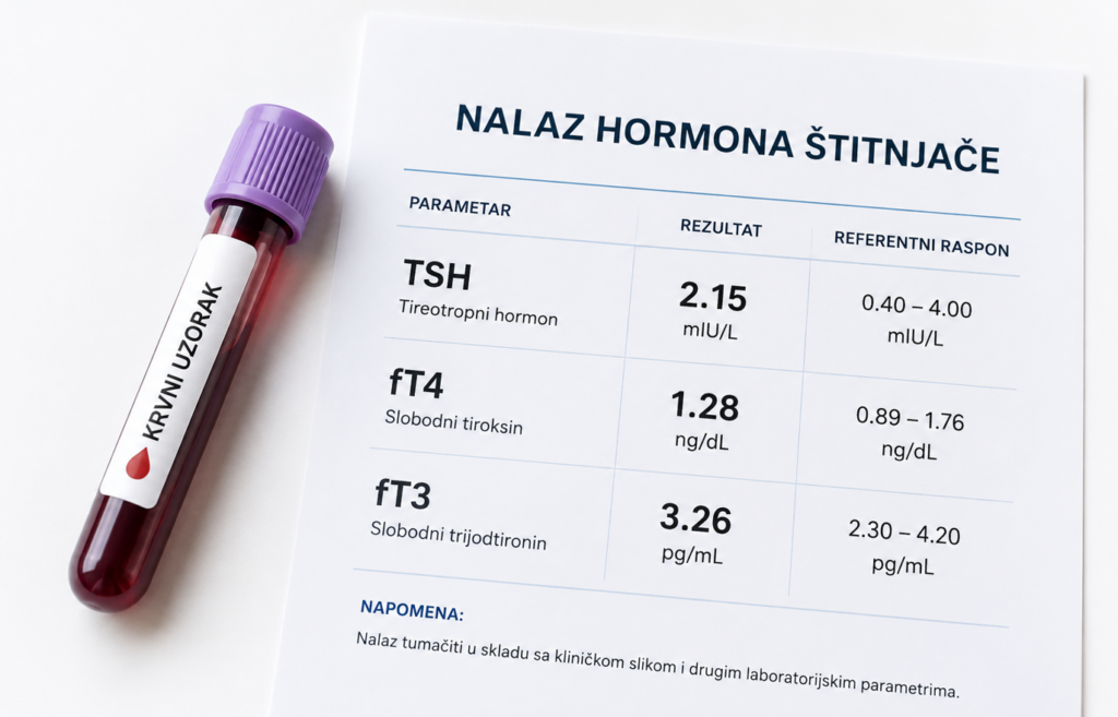 Hormoni stitne zlijezde