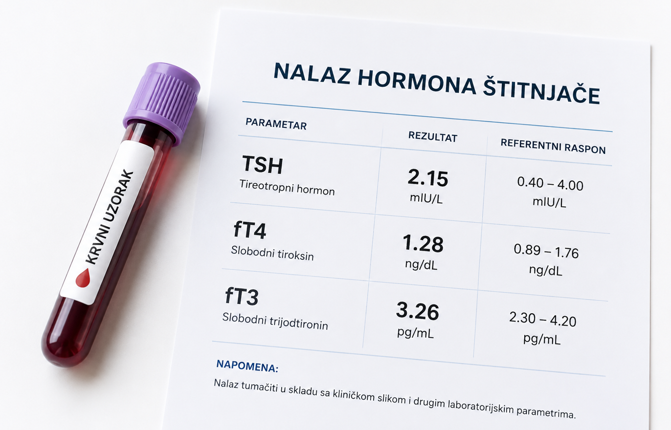 Hormoni stitne zlijezde